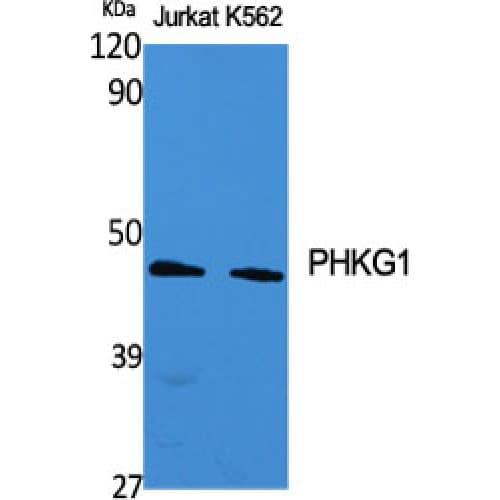 Polyclonal Rabbit anti-Human PHKG1 Antibody (210-290 aa, Internal, WB)