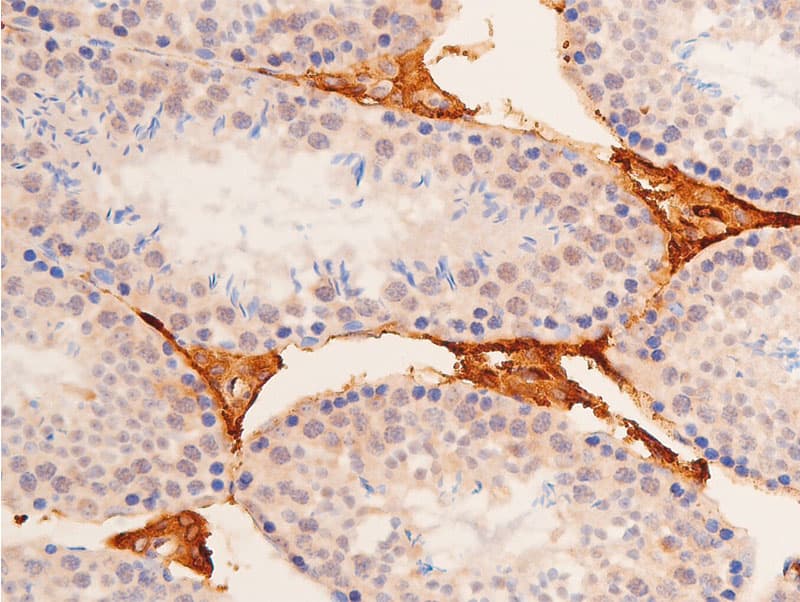 TP53 / p53 Antibody (phospho-Ser392)