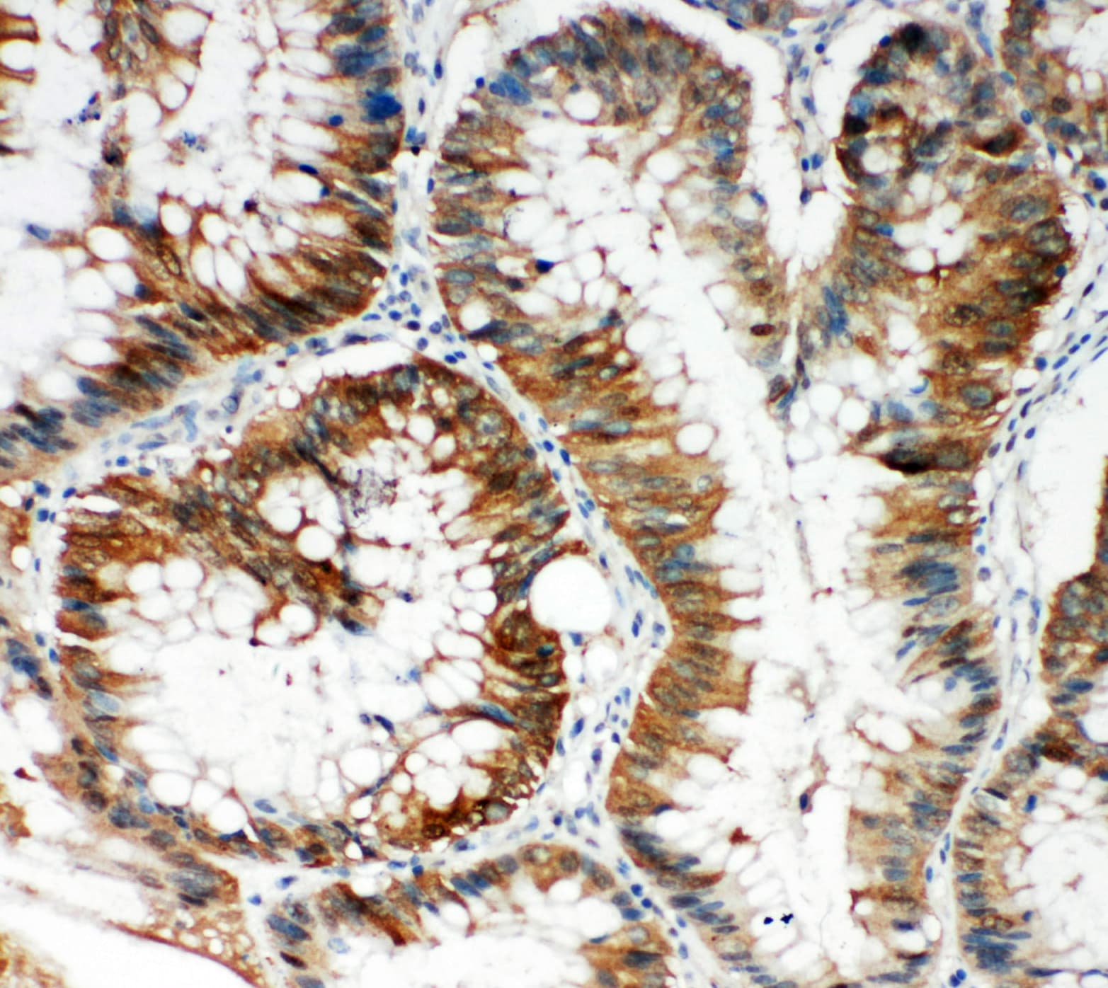 SQSTM1 Antibody (aa91-110)