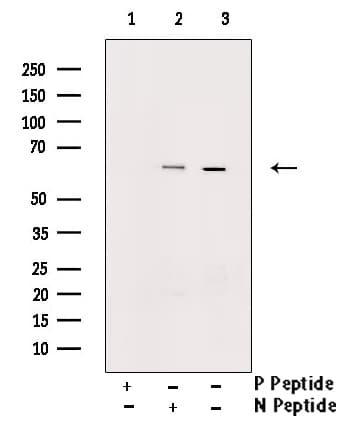 CHEK2 / CHK2 Antibody (phospho-Thr387)