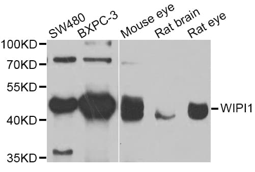 IHC-plus™ Polyclonal Rabbit anti-Human ATG18 / WIPI1 Antibody (IHC, WB)