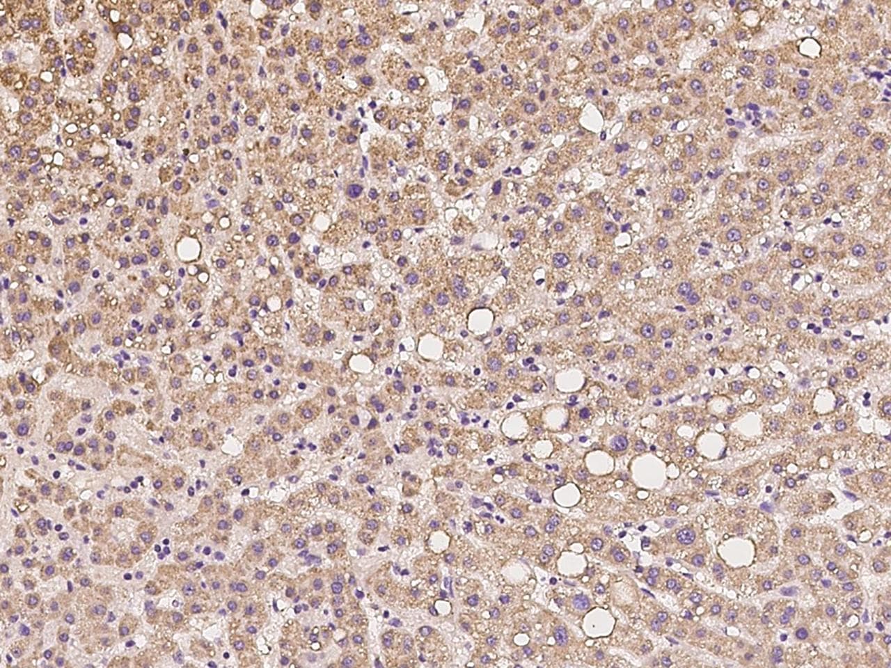 Polyclonal Rabbit anti-Human SCO1 Antibody (IHC)