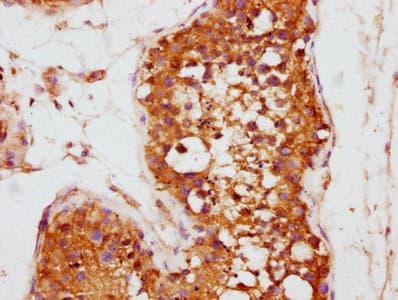 Polyclonal Rabbit anti-Human KLHL12 Antibody (IHC)