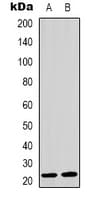 MRPL41 / PIG3 / BMRP Antibody (Internal)