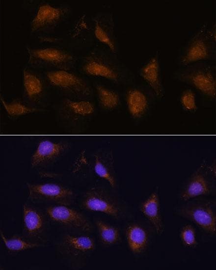 RPS6KA1 / RSK1 Antibody