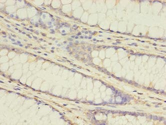 ATG16L1 / ATG16L Antibody (aa1-607)