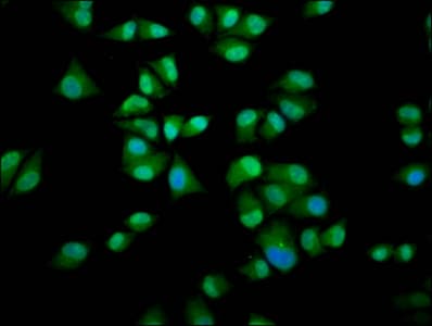 Polyclonal Rabbit anti-Human IMPDH1 Antibody (IHC, IF)