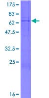 Human FUT3 Protein (Recombinant GST)