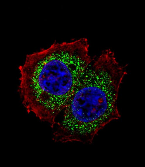 Polyclonal Rabbit anti-Human ER Alpha / Estrogen Receptor Antibody (aa271-300, IF, WB)