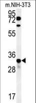 KCTD15 Antibody (aa255-283)