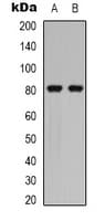 Polyclonal Rabbit anti-Human CALD1 / Caldesmon Antibody (C-Terminus, IHC, IF, WB)