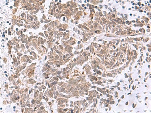 RBFOX2 / RBM9 Antibody