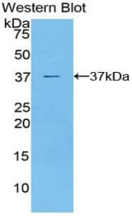 GSK3A / GSK3 Alpha Antibody (aa122-406)