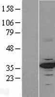 CDK4 Protein (Over-Expression Lysate Myc-DDK (Flag))