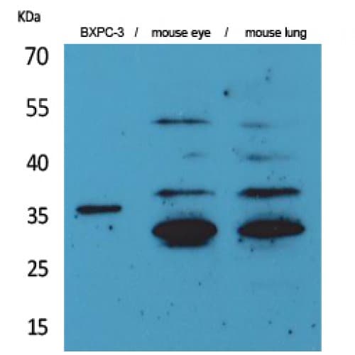 F3 / CD142 / Tissue factor Antibody (131-180 aa, Internal)