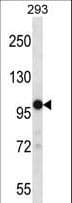 TRPM4 Antibody (aa1121-1149)
