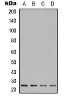 Polyclonal Rabbit anti-Human POLR2E Antibody (Internal, IHC, WB)