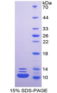 Human HNRNPA2B1 Protein (Recombinant His)