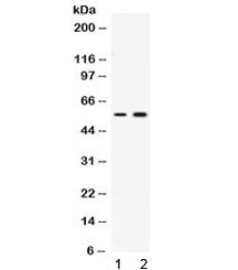 ACTRIIB / ACVR2B Antibody