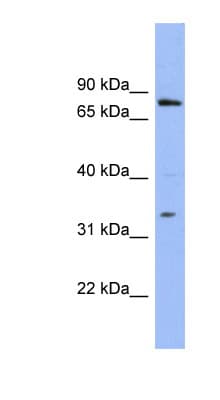 PATZ1 / PATZ Antibody (aa35-84)