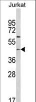 PTAR1 Antibody (aa60-89)