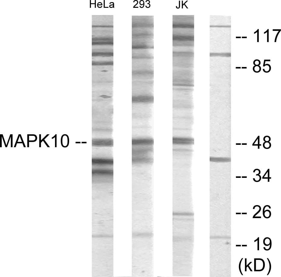 MAPK10 / JNK3 Antibody (aa361-410)
