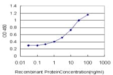 IHC-plus™ FOXO3 / FOXO3A Antibody (clone 3C2)