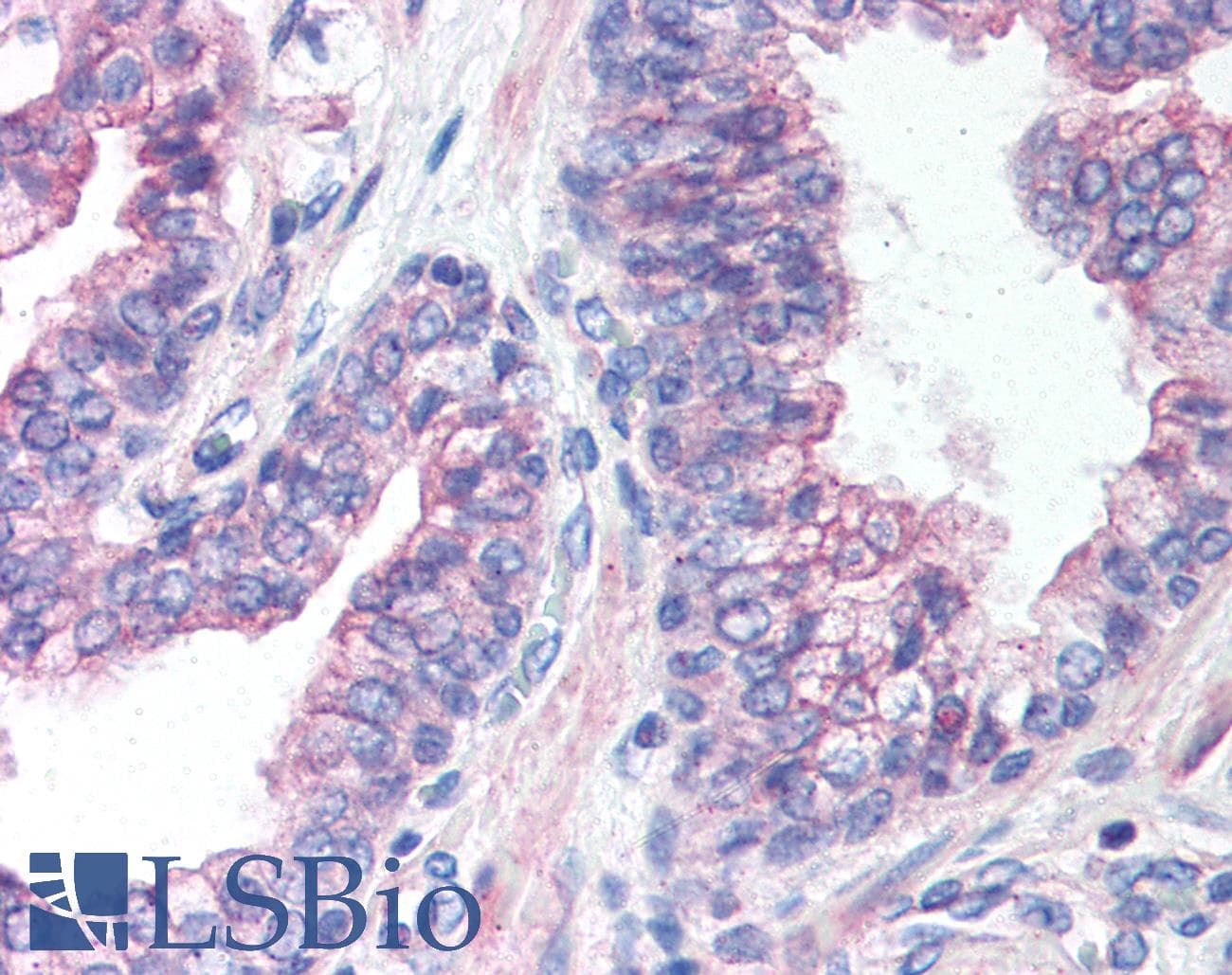 IHC-plus™ EXOC2 / SEC5 Antibody (aa1-17)