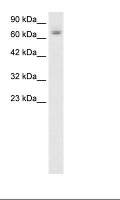 PARP2 Antibody (aa401-450)