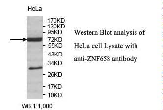 ZNF658 Antibody (aa142-435)