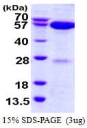 Human NAE1 / APPBP1 Protein (Recombinant His)