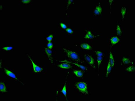 GSTM3 Antibody