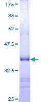 Human USP21 Protein (Recombinant GST, N-terminus)