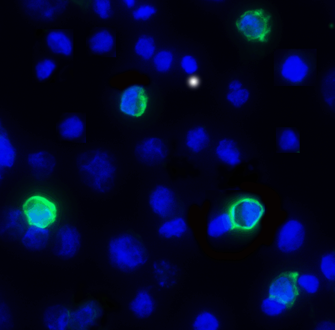 Monoclonal Mouse anti-Human TIGIT Antibody (clone 4A12, IHC, IF, WB)