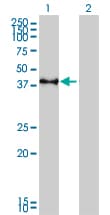 IHC-plus™ CREB1 / CREB Antibody (clone 5F2)