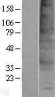 Human TMEM150A Protein (Over-Expression Lysate Myc-DDK (Flag))