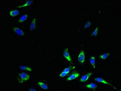 IHC-plus™ Polyclonal Rabbit anti-Human SLC31A2 Antibody (IHC)