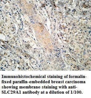SLC29A1 / ENT1 Antibody (N-Terminus)