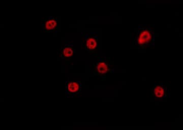 ATAC1 / ZZZ3 Antibody