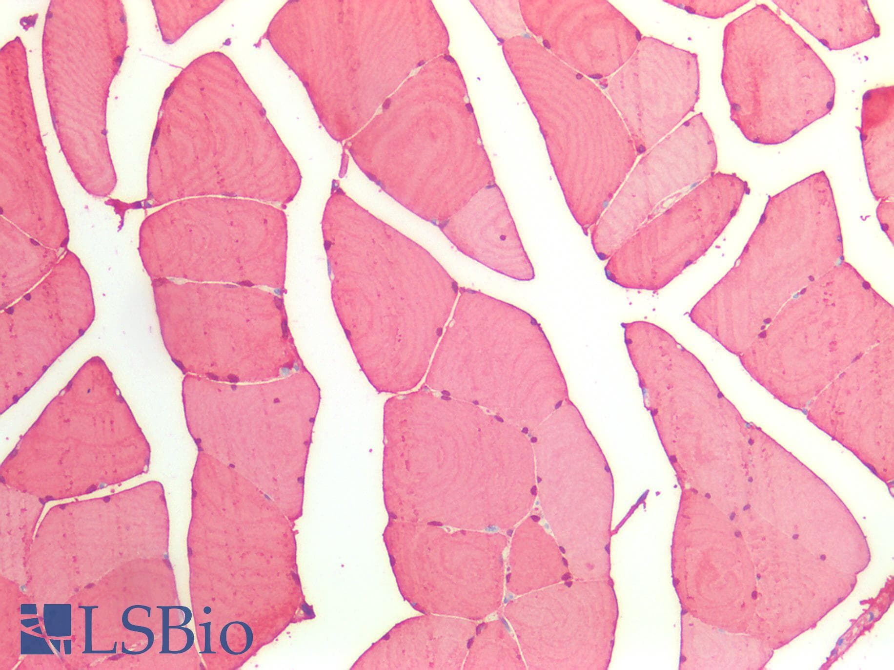 PathPlus™ MB / Myoglobin Antibody (aa1-154)