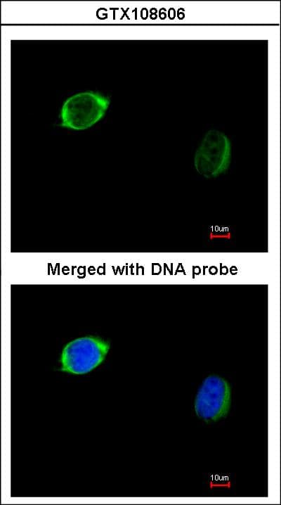 RAB2B Antibody (aa1-216)