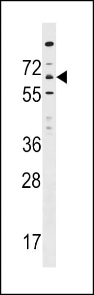 KIAA1754L / ITPRIPL1 Antibody (aa43-71)