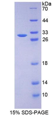 Mouse RAD50 Protein (Recombinant His-S)