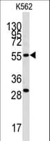 Polyclonal Rabbit anti-Human CLIC5 Antibody (IHC, WB)