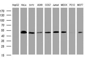 PAI-RBP1 / SERBP1 Antibody (clone OTI2E11)