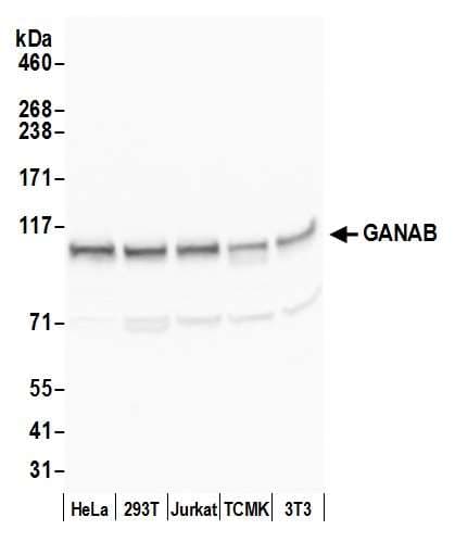 GANAB / Alpha Glucosidase II Antibody (aa200-250)