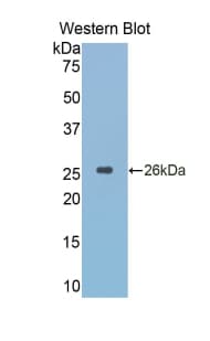 CTSK / Cathepsin K Antibody (aa116-329)