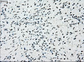 Monoclonal Mouse anti-Human BRAF / B-Raf Antibody (clone OTI4G6, IHC, WB)