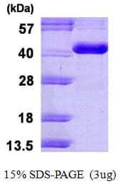 Human CA8 / Carbonic Anhydrase VIII Protein (Recombinant His)