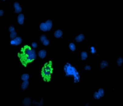 Monoclonal Mouse MYC / c-Myc Antibody (aa408-432, IF, WB)